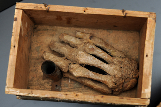 Knochenhand